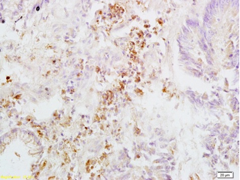 Immunohistochemistry (Formalin/PFA-fixed paraffin-embedded sections) - Anti-Integrin beta 3 antibody (AB203122)