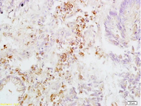 Immunohistochemistry (Formalin/PFA-fixed paraffin-embedded sections) - Anti-Integrin beta 3 antibody (AB203122)