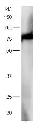 Western blot - Anti-Integrin beta 3 antibody (AB203122)