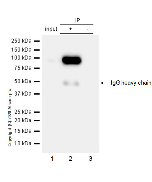 Immunoprecipitation - Anti-Integrin beta 3 antibody [EPR2342] - BSA and Azide free (AB239991), expandable thumbnail
