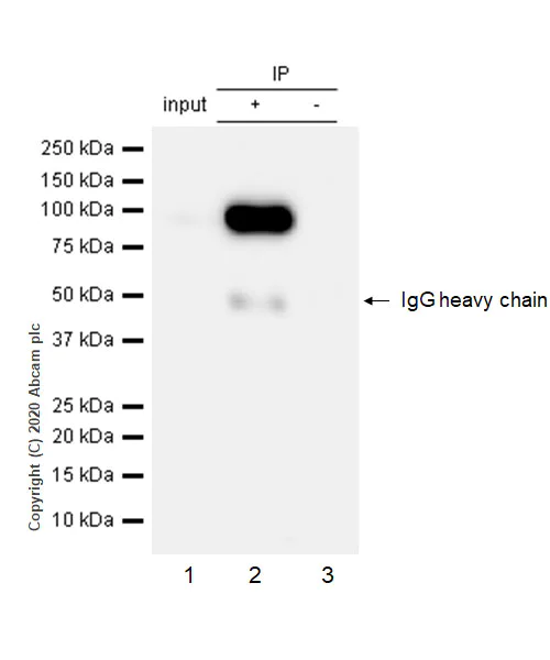Immunoprecipitation - Anti-Integrin beta 3 antibody [EPR2342] - BSA and Azide free (AB239991)