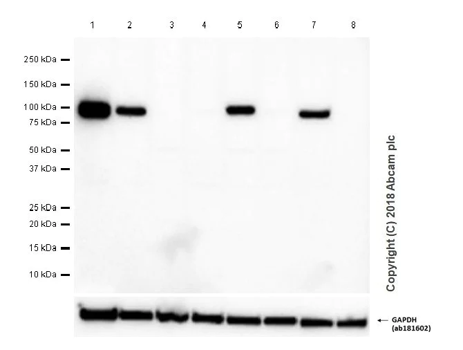 Western blot - Anti-Integrin beta 3 antibody [EPR2342] - BSA and Azide free (AB239991)
