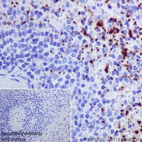 Immunohistochemistry (Formalin/PFA-fixed paraffin-embedded sections) - Anti-Integrin beta 3 antibody [ERP17507] - BSA and Azide free (AB240214)