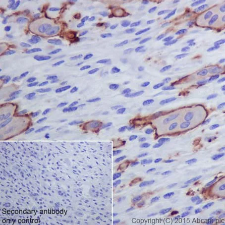Immunohistochemistry (Formalin/PFA-fixed paraffin-embedded sections) - Anti-Integrin beta 3 antibody [ERP17507] - BSA and Azide free (AB240214)