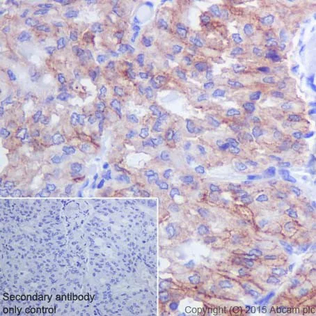 Immunohistochemistry (Formalin/PFA-fixed paraffin-embedded sections) - Anti-Integrin beta 3 antibody [ERP17507] - BSA and Azide free (AB240214)