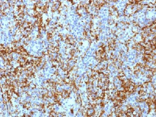 Immunohistochemistry (Formalin/PFA-fixed paraffin-embedded sections) - Anti-Integrin beta 3 antibody [ITGB3/1713] (AB218435)