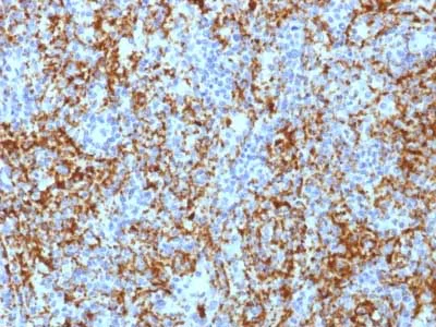 Immunohistochemistry (Formalin/PFA-fixed paraffin-embedded sections) - Anti-Integrin beta 3 antibody [ITGB3/1713] - BSA and Azide free (AB218896)