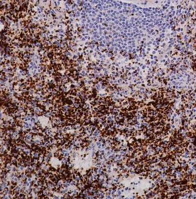 Immunohistochemistry (Formalin/PFA-fixed paraffin-embedded sections) - Anti-Integrin beta 3 antibody [SP324] (AB227702)