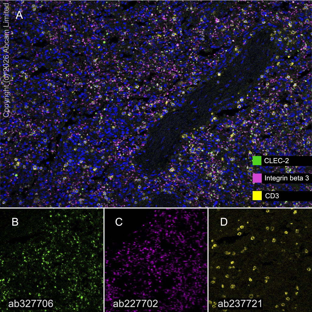 Multiplex immunohistochemistry - Anti-Integrin beta 3 antibody [SP324] (AB227702)