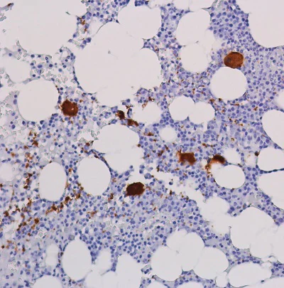 Immunohistochemistry (Formalin/PFA-fixed paraffin-embedded sections) - Anti-Integrin beta 3 antibody [SP324] - BSA and Azide free (AB243939)