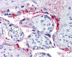 Immunohistochemistry (Formalin/PFA-fixed paraffin-embedded sections) - Anti-Integrin beta 3 antibody [VI-PL2] (AB110131)