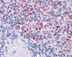Immunohistochemistry (Formalin/PFA-fixed paraffin-embedded sections) - Anti-Integrin beta 3 antibody [VI-PL2] (AB110131)