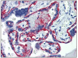 Immunohistochemistry (Formalin/PFA-fixed paraffin-embedded sections) - Anti-Integrin beta 4 antibody [439-9B] (AB110167)