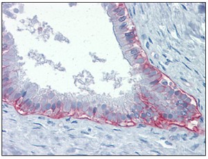 Immunohistochemistry (Formalin/PFA-fixed paraffin-embedded sections) - Anti-Integrin beta 4 antibody [439-9B] (AB110167)
