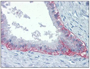 Immunohistochemistry (Formalin/PFA-fixed paraffin-embedded sections) - Anti-Integrin beta 4 antibody [439-9B] (AB110167)