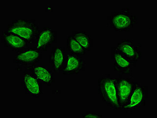 Immunocytochemistry/ Immunofluorescence - Anti-Integrin beta 4 antibody (AB236251), expandable thumbnail