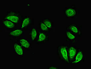 Immunocytochemistry/ Immunofluorescence - Anti-Integrin beta 4 antibody (AB236251)