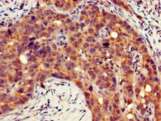 Immunohistochemistry (Formalin/PFA-fixed paraffin-embedded sections) - Anti-Integrin beta 4 antibody (AB236251), expandable thumbnail