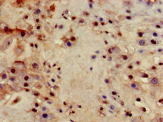 Immunohistochemistry (Formalin/PFA-fixed paraffin-embedded sections) - Anti-Integrin beta 4 antibody (AB236251), expandable thumbnail