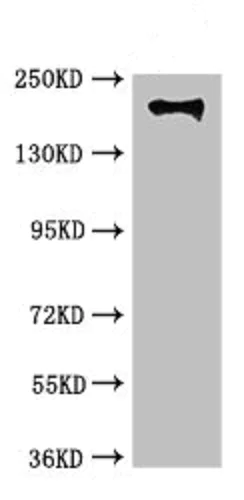 Western blot - Anti-Integrin beta 4 antibody (AB236251)