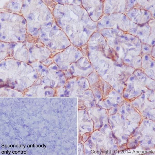 Immunohistochemistry (Formalin/PFA-fixed paraffin-embedded sections) - Anti-Integrin beta 4 antibody [EPR17517] - BSA and Azide free (AB240259), expandable thumbnail