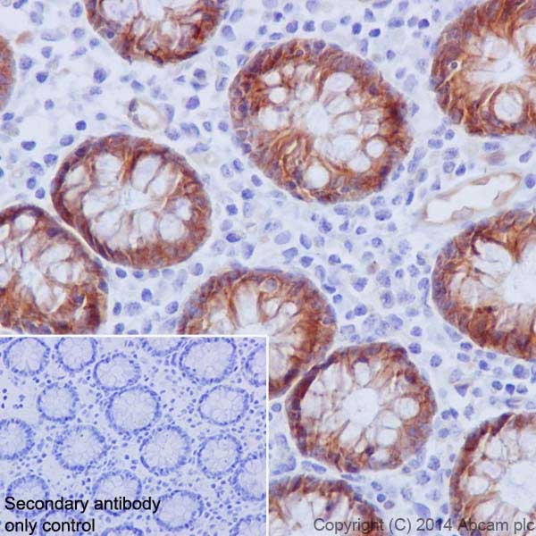 Immunohistochemistry (Formalin/PFA-fixed paraffin-embedded sections) - Anti-Integrin beta 4 antibody [EPR17517] - BSA and Azide free (ab240259), expandable thumbnail