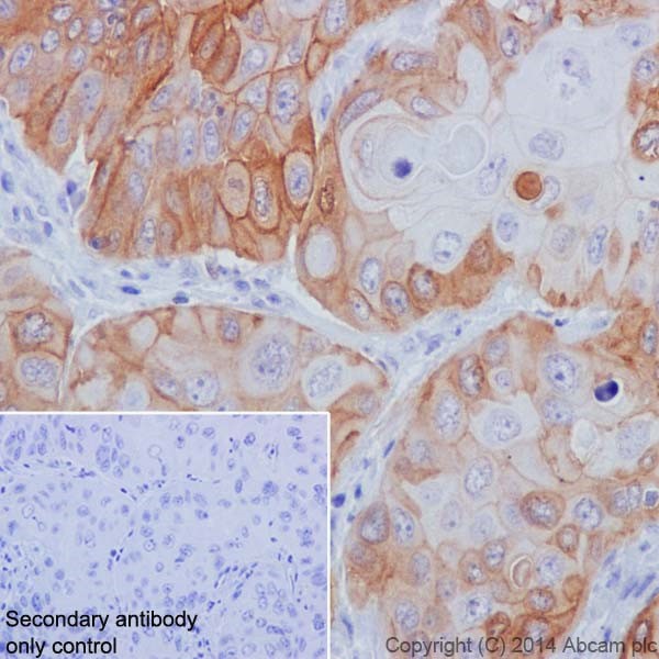 Immunohistochemistry (Formalin/PFA-fixed paraffin-embedded sections) - Anti-Integrin beta 4 antibody [EPR17517] - BSA and Azide free (AB240259), expandable thumbnail