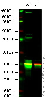 Western blot - Anti-Integrin beta 4 antibody [EPR17517] - BSA and Azide free (AB240259)