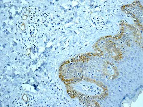 Immunohistochemistry (Formalin/PFA-fixed paraffin-embedded sections) - Anti-Integrin beta 4 antibody [EPR8558(2)] (AB168386)