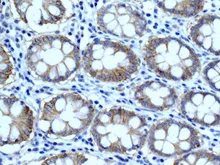 Immunohistochemistry (Formalin/PFA-fixed paraffin-embedded sections) - Anti-Integrin beta 4 antibody [EPR8558(2)] (AB168386)