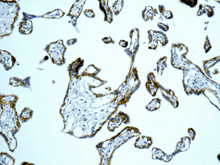 Immunohistochemistry (Formalin/PFA-fixed paraffin-embedded sections) - Anti-Integrin beta 4 antibody [EPR8558(2)] (AB168386)