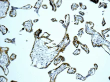 Immunohistochemistry (Formalin/PFA-fixed paraffin-embedded sections) - Anti-Integrin beta 4 antibody [EPR8558(2)] (AB168386)
