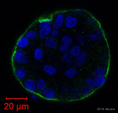 Immunocytochemistry/ Immunofluorescence - Anti-Integrin beta 4 antibody [EPR8559] - BSA and Azide free (AB240078)
