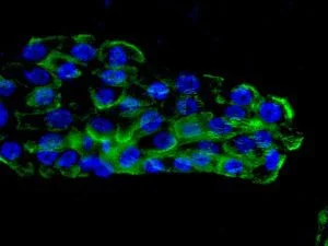 Immunocytochemistry/ Immunofluorescence - Anti-Integrin beta 4 antibody [EPR8559] - BSA and Azide free (AB240078)
