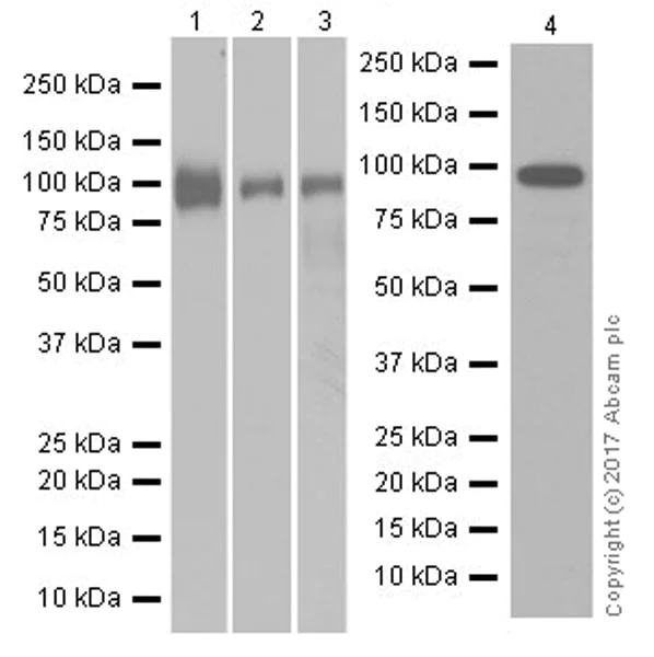 Western blot - Anti-Integrin beta 5 antibody [EPR19170] (AB184312)