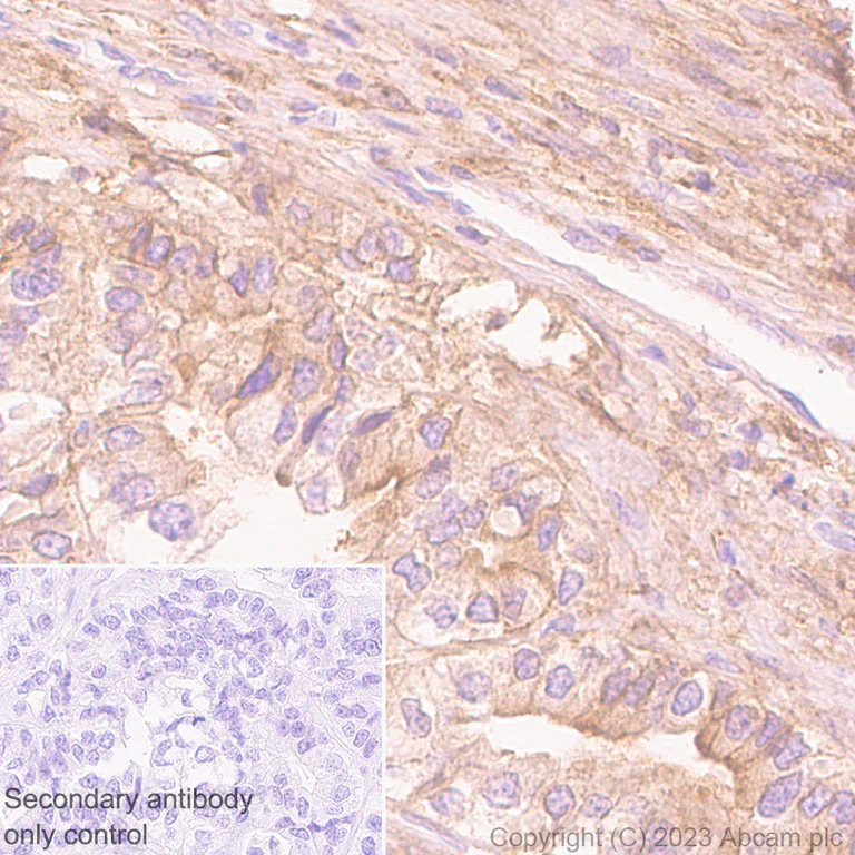 Immunohistochemistry (Formalin/PFA-fixed paraffin-embedded sections) - Anti-Integrin beta 5 antibody [EPR26930-21] (AB309092)