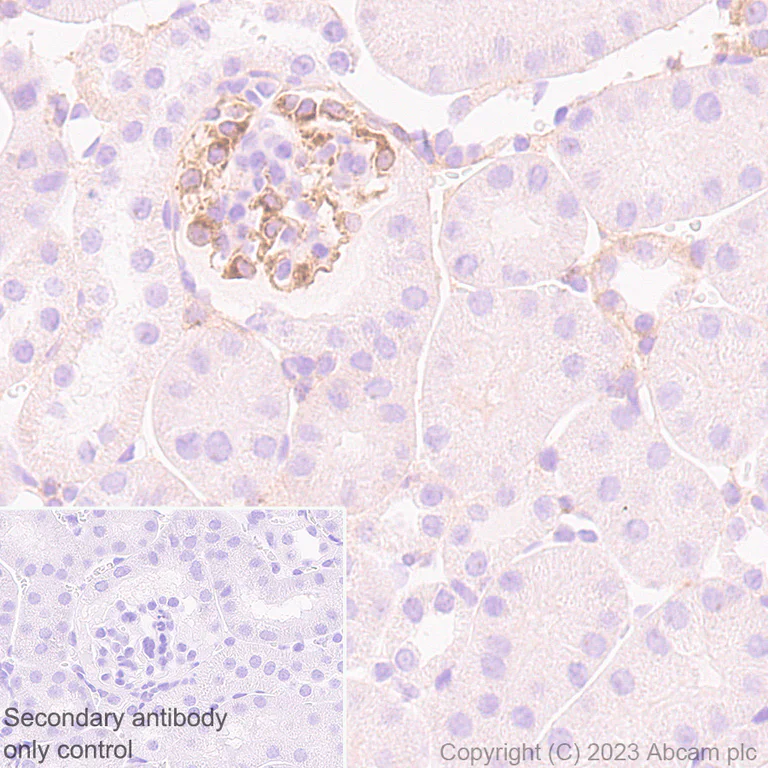 Immunohistochemistry (Formalin/PFA-fixed paraffin-embedded sections) - Anti-Integrin beta 5 antibody [EPR26930-21] (AB309092)