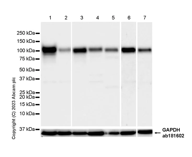 Western blot - Anti-Integrin beta 5 antibody [EPR26930-21] (AB309092)
