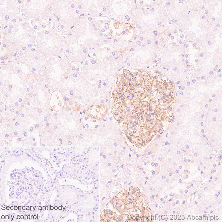 Immunohistochemistry (Formalin/PFA-fixed paraffin-embedded sections) - Anti-Integrin beta 5 antibody [EPR26930-21] - BSA and Azide free (AB309093)