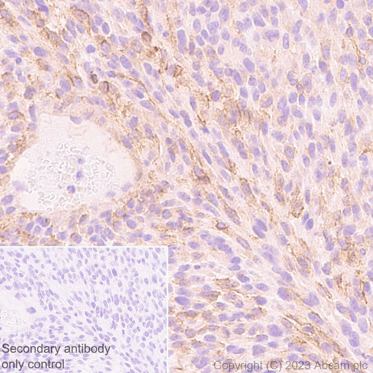 Immunohistochemistry (Formalin/PFA-fixed paraffin-embedded sections) - Anti-Integrin beta 5 antibody [EPR26930-21] - BSA and Azide free (AB309093)