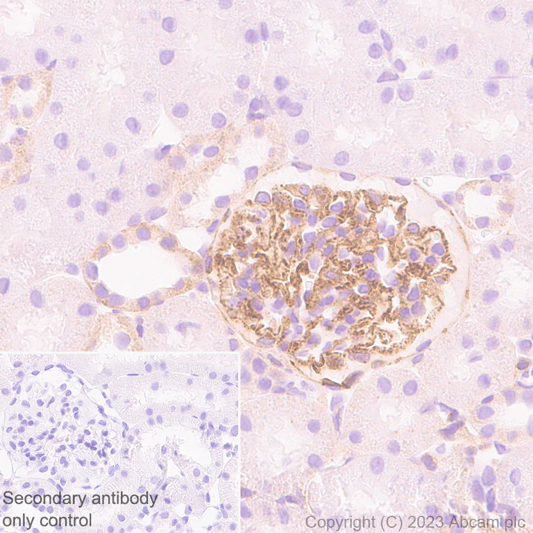 Immunohistochemistry (Formalin/PFA-fixed paraffin-embedded sections) - Anti-Integrin beta 5 antibody [EPR26930-21] - BSA and Azide free (AB309093)
