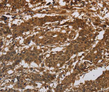 Immunohistochemistry (Formalin/PFA-fixed paraffin-embedded sections) - Anti-Integrin beta 7 antibody (AB198796)