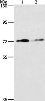 Western blot - Anti-Integrin beta 7 antibody (AB198796)
