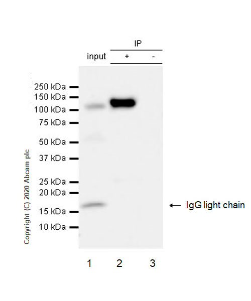 Immunoprecipitation - Anti-Integrin beta 7 antibody [EP5948] - BSA and Azide free (AB216688), expandable thumbnail