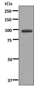 Western blot - Anti-Integrin beta 7 antibody [EP5948] - BSA and Azide free (AB216688), expandable thumbnail