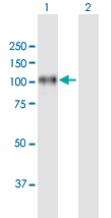 Western blot - Anti-Integrin beta 8 antibody (AB172007)