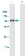 Western blot - Anti-Integrin beta 8 antibody (AB172007)