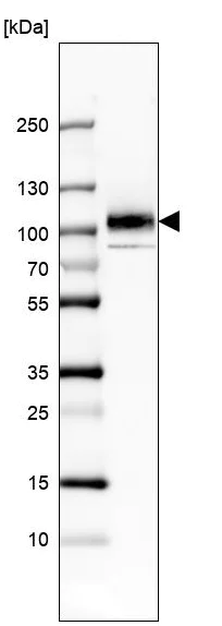 Western blot - Anti-Integrin beta 8 antibody [CL7290] (AB243023)