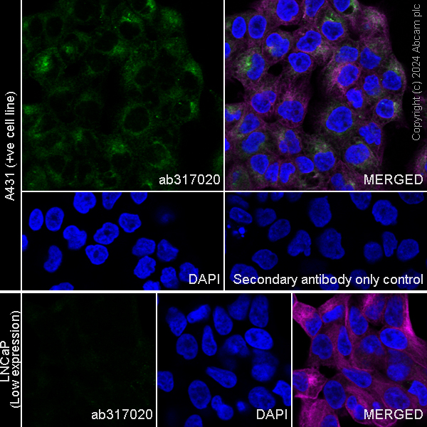 Immunocytochemistry/ Immunofluorescence - Anti-Integrin beta 8 antibody [EPR27246-85] (AB317020), expandable thumbnail