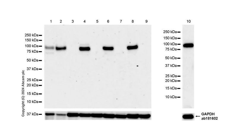 Western blot - Anti-Integrin beta 8 antibody [EPR27246-85] (AB317020)